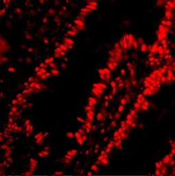 Anti-PHAP antibody used in IHC (Paraffin sections) (IHC-P). GTX25987