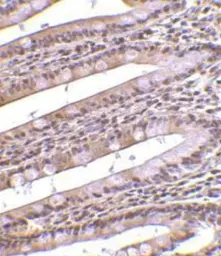 Anti-PHAP antibody used in Immunohistochemistry (IHC). GTX25987