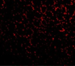 Anti-ANP32A antibody used in IHC (Paraffin sections) (IHC-P). GTX25991