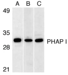 Anti-ANP32A antibody used in Western Blot (WB). GTX25991