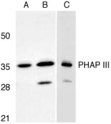 Anti-PHAP3 antibody used in Western Blot (WB). GTX25993
