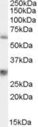 Anti-VAM1 antibody, N-term used in Western Blot (WB). GTX25995