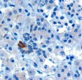 Anti-PARD6A antibody, C-term used in IHC (Paraffin sections) (IHC-P). GTX26022