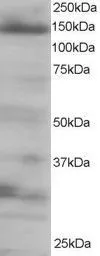 Anti-EIF4ENIF1 antibody, C-term used in Western Blot (WB). GTX26034
