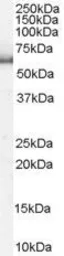 Anti-SRP1 antibody, N-term used in Western Blot (WB). GTX26035