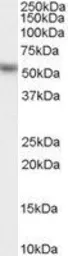 Anti-KPNA2 antibody, C-term used in Western Blot (WB). GTX26036