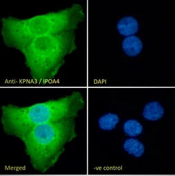 Anti-KPNA3 antibody, C-term used in Immunocytochemistry/ Immunofluorescence (ICC/IF). GTX26038