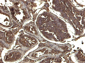 Anti-KPNA3 antibody, C-term used in IHC (Paraffin sections) (IHC-P). GTX26038
