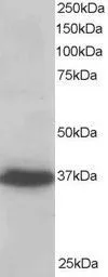 Anti-PDLIM4 antibody, C-term used in Western Blot (WB). GTX26045