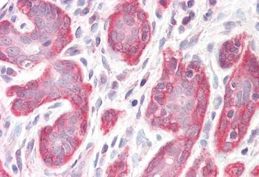 Anti-PDLIM4 antibody, C-term used in IHC (Paraffin sections) (IHC-P). GTX26045