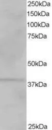 Anti-VPS26A antibody, C-term used in Western Blot (WB). GTX26051
