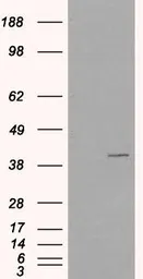 Anti-VPS26A antibody, C-term used in Western Blot (WB). GTX26051