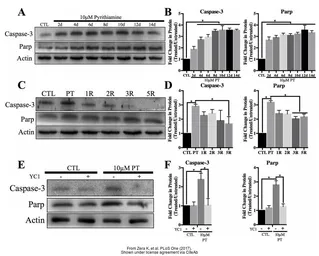 Anti-PARP antibody used in Western Blot (WB). GTX26079
