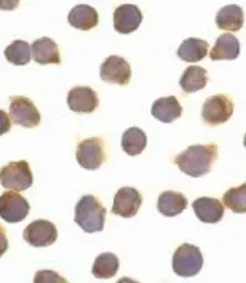 Anti-FLIP antibody used in Immunocytochemistry/ Immunofluorescence (ICC/IF). GTX26144