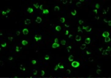 Anti-FLIP antibody used in Immunocytochemistry/ Immunofluorescence (ICC/IF). GTX26144