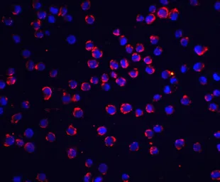 Anti-FLIP antibody used in Immunocytochemistry/ Immunofluorescence (ICC/IF). GTX26144