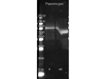 Anti-Plasminogen antibody used in Western Blot (WB). GTX26189