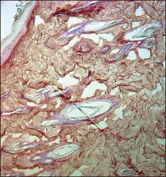 Anti-Collagen III antibody [FH-7A] used in IHC (Paraffin sections) (IHC-P). GTX26310