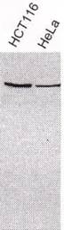 Anti-XRCC3 antibody used in Western Blot (WB). GTX26494
