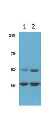 Anti-CDK9 antibody used in Western Blot (WB). GTX26544