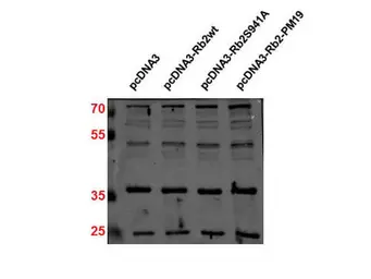 Anti-p27 Kip1 antibody used in Western Blot (WB). GTX26547