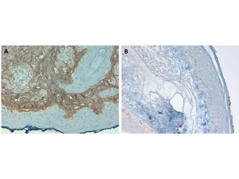 Anti-Collagen I antibody (Biotin) used in IHC (Paraffin sections) (IHC-P). GTX26577