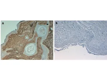 Anti-Collagen I antibody (Biotin) used in IHC (Paraffin sections) (IHC-P). GTX26577