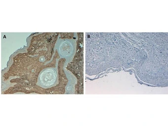 Anti-Collagen I antibody (Biotin) used in IHC (Paraffin sections) (IHC-P). GTX26577