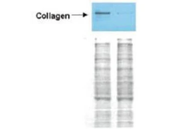 Anti-Collagen I antibody (Biotin) used in Western Blot (WB). GTX26577