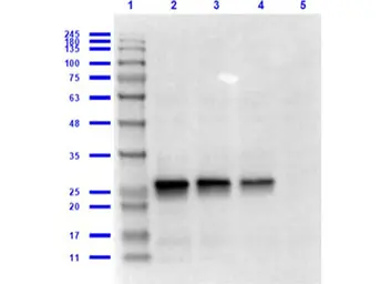 Anti-GST tag antibody used in Western Blot (WB). GTX26633