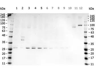Anti-TNF alpha antibody used in Western Blot (WB). GTX26671