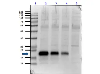 Anti-IL6 antibody used in Western Blot (WB). GTX26672