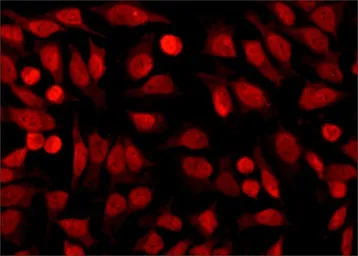 Anti-HDAC1 antibody used in Immunocytochemistry/ Immunofluorescence (ICC/IF). GTX27028