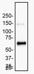 Anti-MMP2 antibody [2C1] used in Western Blot (WB). GTX27033