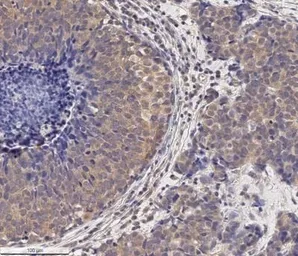 Anti-MMP2 antibody [2C1] used in IHC (Paraffin sections) (IHC-P). GTX27033