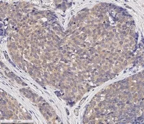 Anti-MMP2 antibody [2C1] used in IHC (Paraffin sections) (IHC-P). GTX27033