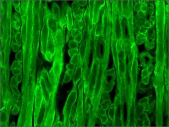 Anti-Dystrophin antibody [MANDYS8] used in IHC (Frozen sections) (IHC-Fr). GTX27163