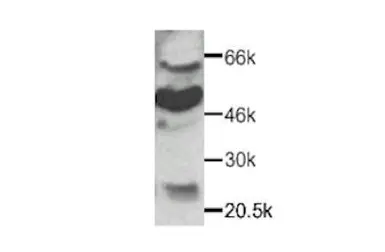 Anti-CX3CR1 antibody used in Western Blot (WB). GTX27201