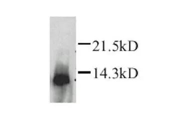Anti-Lymphotactin antibody used in Western Blot (WB). GTX27218