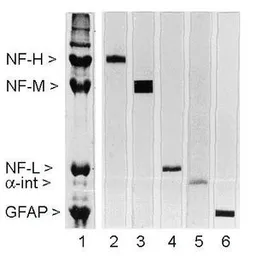Anti-NF-M antibody [3H11] used in Western Blot (WB). GTX27256