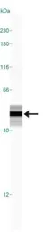 Anti-GFAP antibody used in Western Blot (WB). GTX27260