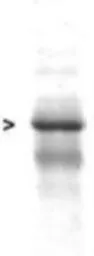 Anti-GFAP antibody used in Western Blot (WB). GTX27260