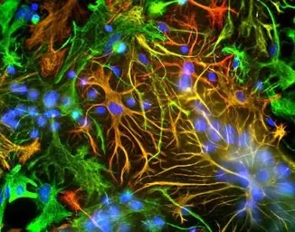 Anti-GFAP antibody used in Immunocytochemistry/ Immunofluorescence (ICC/IF). GTX27260