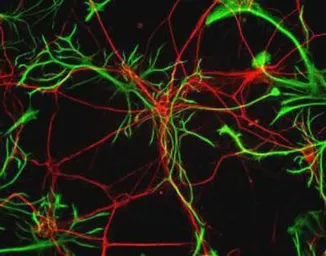 Anti-GFAP antibody used in Immunocytochemistry/ Immunofluorescence (ICC/IF). GTX27260