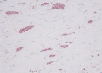 Anti-RANTES antibody used in IHC (Paraffin sections) (IHC-P). GTX27314