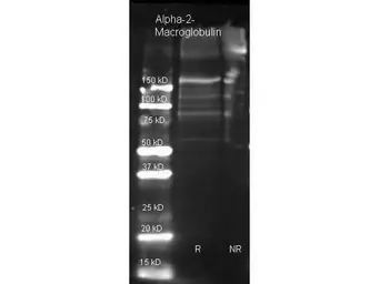 Anti-alpha 2 Macroglobulin antibody used in Western Blot (WB). GTX27337