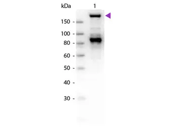 Anti-alpha 2 Macroglobulin antibody used in Western Blot (WB). GTX27337