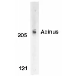 Anti-Acinus antibody used in Western Blot (WB). GTX27352