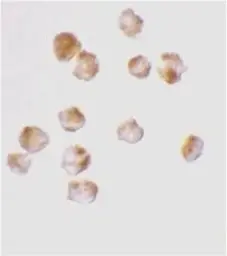 Anti-Acinus antibody used in Immunocytochemistry/ Immunofluorescence (ICC/IF). GTX27352