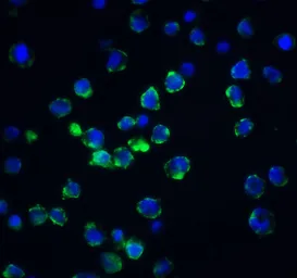 Anti-Acinus antibody used in Immunocytochemistry/ Immunofluorescence (ICC/IF). GTX27352